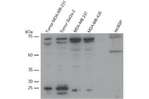 Western Blot analysis of BSP expression in different cell lines. (BSP Antikörper  (AA 201-211))