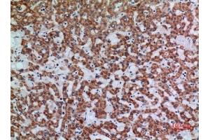 Immunohistochemical analysis of paraffin-embedded human-liver, antibody was diluted at 1:100.