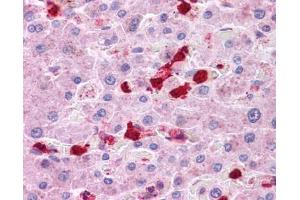 Immunohistochemistry (IHC) image for anti-Leucine Rich Repeat Containing 8 Family, Member B (LRRC8B) (Middle Region) antibody (ABIN635111)