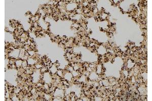 ABIN6276428 at 1/100 staining Rat lung tissue by IHC-P.
