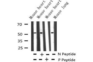Western Blotting (WB) image for anti-Microphthalmia-Associated Transcription Factor (MITF) (pSer180), (pSer73) antibody (ABIN6255037)