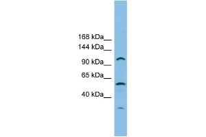 WB Suggested Anti-CHTF18 Antibody Titration: 0. (CTF18 Antikörper  (Middle Region))