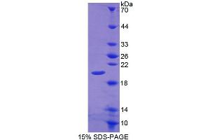 SDS-PAGE analysis of Rat CALY Protein.