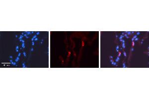 LMAN2 antibody - N-terminal region          Formalin Fixed Paraffin Embedded Tissue:  Human Lung Tissue    Observed Staining:  Cytoplasm of pneumocytes   Primary Antibody Concentration:  1:100    Other Working Concentrations:  1/600    Secondary Antibody:  Donkey anti-Rabbit-Cy3    Secondary Antibody Concentration:  1:200    Magnification:  20X    Exposure Time:  0. (LMAN2 Antikörper  (N-Term))