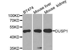 Western blot analysis of extracts of various cell lines, using DUSP1 antibody. (DUSP1 Antikörper)