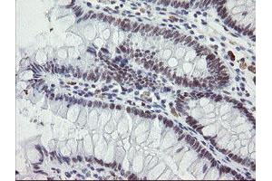 Immunohistochemical staining of paraffin-embedded Human colon tissue using anti-ZBED1 mouse monoclonal antibody. (ZBED1 Antikörper)