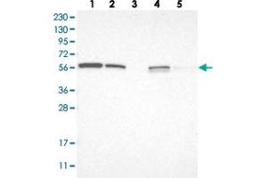 Western blot analysis of Lane 1: RT-4, Lane 2: U-251 MG, Lane 3: Human Plasma, Lane 4: Liver, Lane 5: Tonsil with LETM2 polyclonal antibody  at 1:250-1:500 dilution. (LETM2 Antikörper)