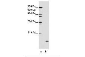 Image no. 2 for anti-Small Nuclear Ribonucleoprotein Polypeptide A (SNRPA) (AA 176-225) antibody (ABIN203017) (SNRPA1 Antikörper  (AA 176-225))