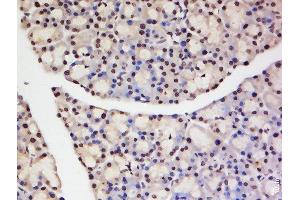 Immunohistochemistry (Paraffin-embedded Sections) (IHC (p)) image for anti-Tumor Necrosis Factor, alpha-Induced Protein 1 (Endothelial) (TNFAIP1) (AA 231-316) antibody (ABIN677603)