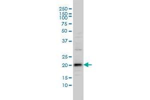 C20orf102 monoclonal antibody (M01), clone 3B9 Western Blot analysis of C20orf102 expression in IMR-32 . (VSTM2L Antikörper  (AA 25-204))