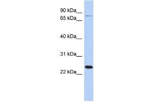 RPS7 antibody used at 1 ug/ml to detect target protein. (RPS7 Antikörper  (Middle Region))