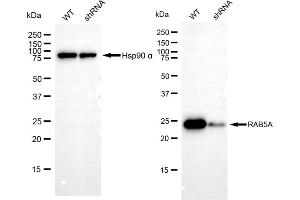 Western blotting analysis using RAB5A antibody (ABIN7800098). (Rekombinanter RAB5 Antikörper)