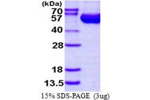 SDS-PAGE (SDS) image for Argininosuccinate Lyase (ASL) (AA 1-464) protein (His tag) (ABIN667597)