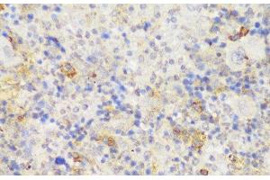 Immunohistochemistry of paraffin-embedded Mouse spleen using GCC2 Polyclonal Antibody at dilution of 1:150 (40x lens). (GCC2 Antikörper)