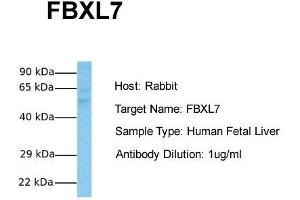 Host:  Rabbit  Target Name:  FBXL7  Sample Tissue:  Human Fetal Liver  Antibody Dilution:  1. (FBXL7 Antikörper  (N-Term))