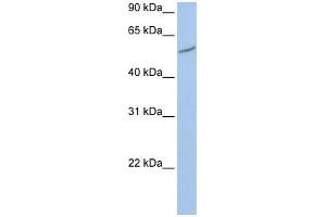 WB Suggested Anti-RIOK3  Antibody Titration: 0. (RIOK3 Antikörper  (C-Term))