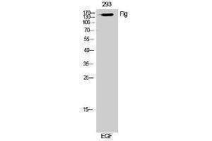 Western Blotting (WB) image for anti-Filaggrin (FLG) (Ser378) antibody (ABIN3184631) (Filaggrin Antikörper  (Ser378))