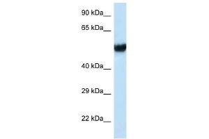 Western Blot showing IFT74 antibody used at a concentration of 1 ug/ml against MCF7 Cell Lysate (IFT74 Antikörper  (C-Term))