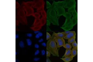 ABIN6257876 and ABIN6275617 staining Hela cells(30 min of UV treatment) by IF/ICC. (SYT13 Antikörper  (Internal Region))