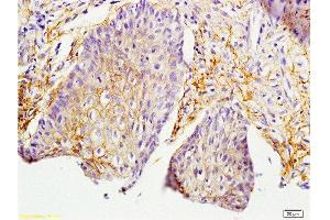 Formalin-fixed and paraffin embedded rat skin labeled with Anti-MIF Polyclonal Antibody, Unconjugated  at 1:200 followed by conjugation to the secondary antibody and DAB staining. (MIF Antikörper  (AA 51-115))