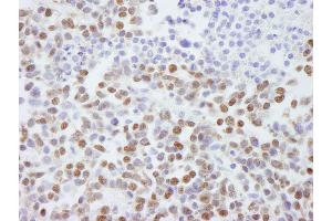 Immunohistochemistry (IHC) image for anti-Scaffold Attachment Factor B2 (SAFB2) (AA 175-225) antibody (ABIN7448785)