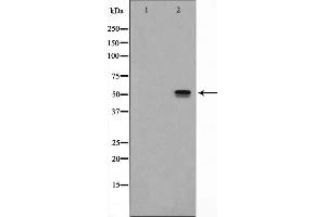 Western blot analysis on HeLa cell lysate using ITPK1 Antibody,The lane on the left is treated with the antigen-specific peptide. (ITPK1 Antikörper  (Internal Region))