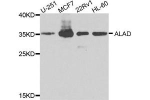 Western blot analysis of extracts of various cells, using ALAD antibody. (ALAD Antikörper)