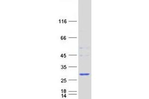 Western Blotting (WB) image for Haloacid Dehalogenase-Like Hydrolase Domain Containing 1 (HDHD1) (Transcript Variant 2) protein (Myc-DYKDDDDK Tag) (ABIN2722537)