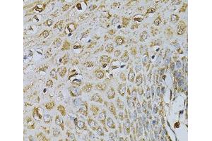 Immunohistochemistry (Paraffin-embedded Sections) (IHC (p)) image for anti-Cytidine Deaminase (CDA) antibody (ABIN7257523)