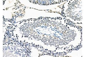 ABIN6258041 and ABIN6273478 at 1/100 staining Rat testis tissue by IHC-P.