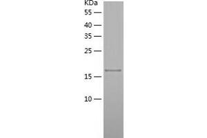 ENPP5 Protein (AA 25-204) (His tag)