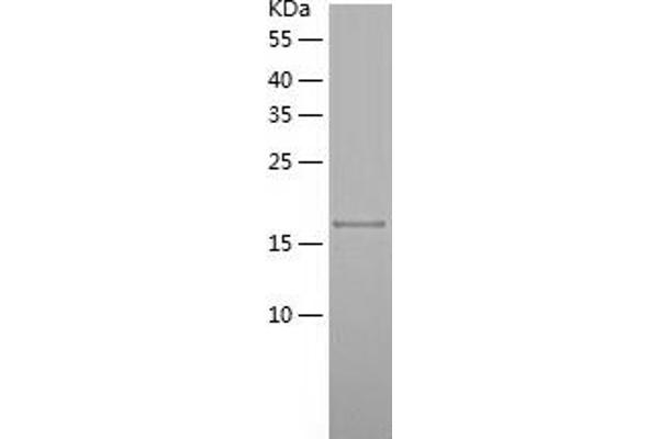 ENPP5 Protein (AA 25-204) (His tag)