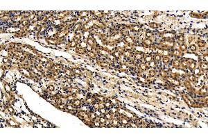 Detection of IRAK4 in Mouse Kidney Tissue using Polyclonal Antibody to Interleukin 1 Receptor Associated Kinase 4 (IRAK4) (IRAK4 Antikörper  (AA 189-427))