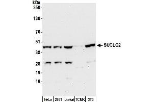 anti-Succinate-CoA Ligase, GDP-Forming, beta Subunit (SUCLG2) (AA 382-432) antibody