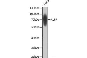 Western blot analysis of extracts of HeLa cells using ALPP Polyclonal Antibody at dilution of 1:1000. (PLAP Antikörper)