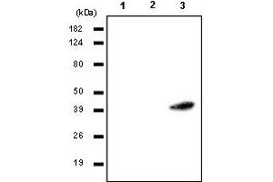 Western Blotting (WB) image for anti-Ras Association (RalGDS/AF-6) Domain Family Member 1 (RASSF1) antibody (ABIN165456) (RASSF1 Antikörper)