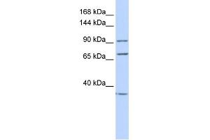 WB Suggested Anti-EEF2 Antibody Titration: 0. (EEF2 Antikörper  (N-Term))