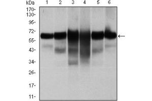 Western blot analysis using CK5 antibody against human CK5 (AA: 158-272) recombinant protein. (Cytokeratin 5 Antikörper)