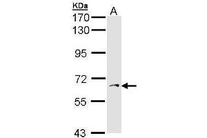 Western Blotting (WB) image for anti-3'-phosphoadenosine 5'-phosphosulfate Synthase 1 (PAPSS1) antibody (ABIN2855665)