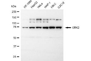 Western blotting analysis using GRK2 antibody (ABIN7797537). (GRK2 Antikörper)