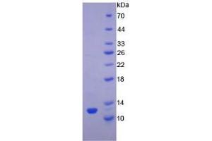 SDS-PAGE analysis of Rat TGFa Protein. (TGFA Protein)