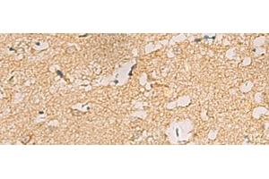 Immunohistochemistry of paraffin-embedded Human brain tissue using CNST Polyclonal Antibody at dilution of 1:70(x200)
