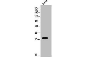 Western Blot analysis of HELA cells using CMTM4 Polyclonal Antibody (CMTM4 Antikörper  (Internal Region))