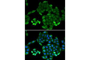 Immunofluorescence (IF) image for anti-6-Pyruvoyltetrahydropterin Synthase (PTS) antibody (ABIN1980322) (PTS Antikörper)