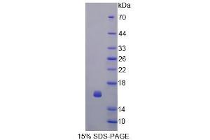 SDS-PAGE analysis of Human CDK2AP1 Protein. (CDK2AP1 Protein)