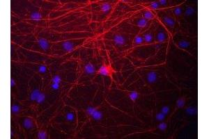Immunostaining of cultured rat neurons and glia showing labeling of NF-M in red. (NEFM Antikörper  (C-Term))