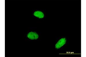 Immunofluorescence of monoclonal antibody to AKIRIN2 on HeLa cell. (AKIRIN2 Antikörper  (AA 1-203))