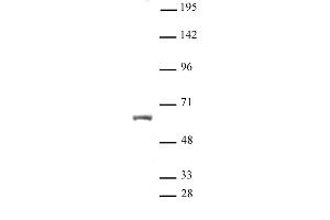 HNF4A antibody (pAb) tested by Western blot. (HNF4A Antikörper  (N-Term))