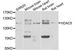 Western blot analysis of extracts of various cell lines, using HDAC5 antibody. (HDAC5 Antikörper)