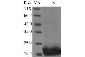 Western Blotting (WB) image for Peptidoglycan Recognition Protein 1 (PGLYRP1) protein (His tag) (ABIN7320401) (PGLYRP1 Protein (His tag))